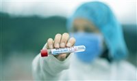 Novo teste por saliva pode ser alternativa rápida e barata Novo teste por saliva pode ser alternativa rápida e barata